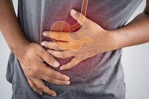 Trào ngược dạ dày có mối liên quan đến lo âu, stress?