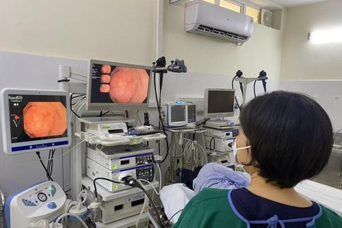 Bệnh viện 19-8 dùng nội soi AI phát hiện sớm ung thư