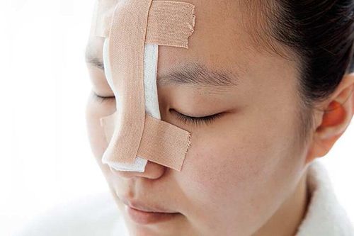 Những trường hợp không nên nâng mũi