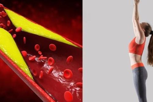 8 tư thế yoga kích thích tiêu hóa, kiểm soát cholesterol