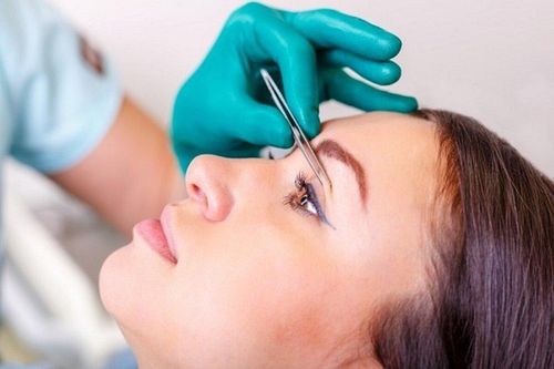 Người bị cận thị có nên cắt mí mắt?