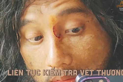 Mai Tài Phến bị rách mũi trên phim trường 'Đất rừng phương Nam'