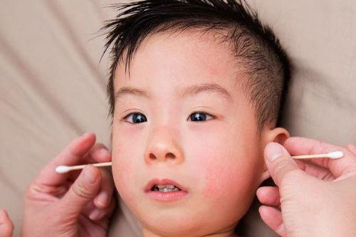 Trẻ giảm thính lực vì bố mẹ lấy ráy tai sai cách