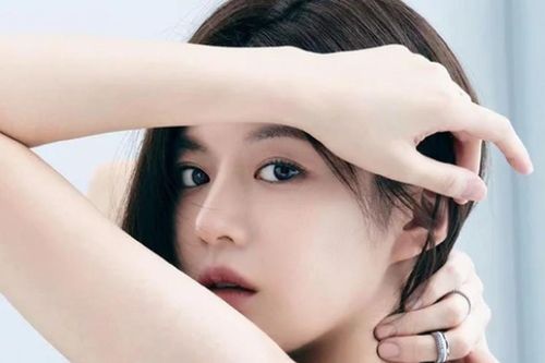 Go Yoon Jung đang là diễn viên hot nhất Hàn Quốc