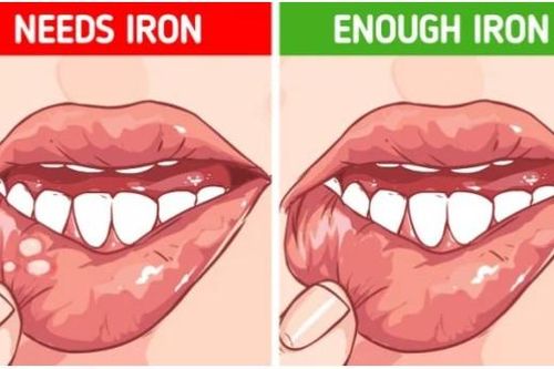 4 mẹo đơn giản giúp bạn phát hiện các vấn đề cơ thể đang gặp phải