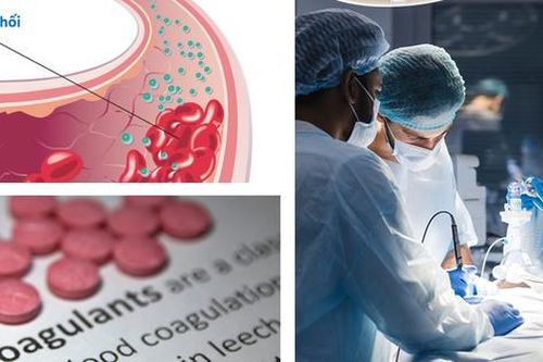 Thuốc chống đông máu và những rủi ro cần biết khi sử dụng