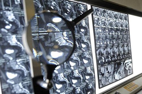 Nga phát triển thuốc điều trị nhiều loại ung thư, hiệu quả có thể tới 90%