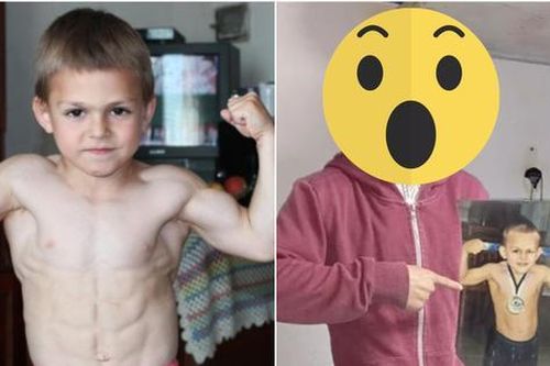 Cuộc sống của 'cậu bé khỏe nhất thế giới' hiện ra sao sau 14 năm gây bất ngờ với vẻ ngoài?