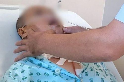 Loại ung thư khiến người bệnh không thể ăn uống, hơi thở có mùi nồng nặc