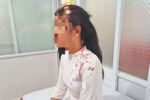 Nữ sinh lớp 10 ở Đắk Lắk bị bạn dùng guốc đánh lên đầu phải khâu 4 mũi