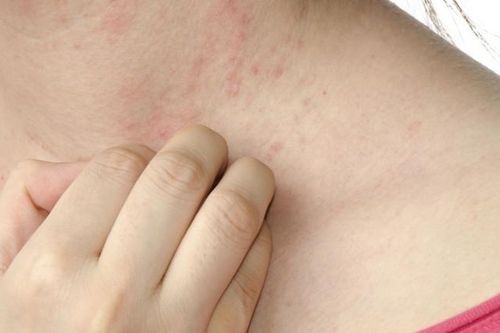 Đi khám da liễu vì ngứa ngáy, chẩn đoán của bác sĩ gây bất ngờ