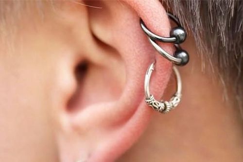 Nhiều thanh niên phải nhập viện do bấm lỗ tai