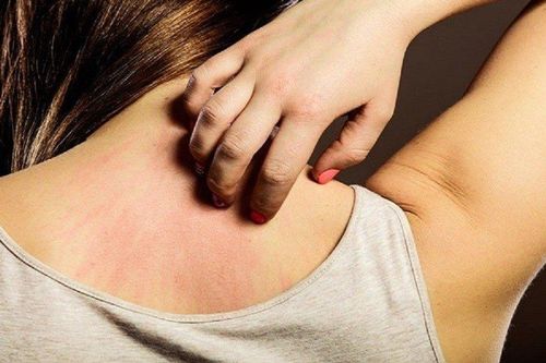 Đi khám vì ngứa ngáy, người phụ nữ bất ngờ với chẩn đoán của bác sĩ