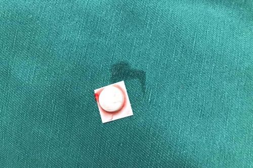 Nhập viện vì uống thuốc viên nuốt cả vỏ nilon