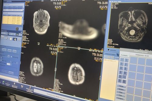Bệnh viện Ung bướu TP.HCM sửa xong máy MRI, các cơ sở khác vẫn hỗ trợ