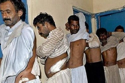 Pakistan triệt phá đường dây buôn bán nội tạng hàng trăm người