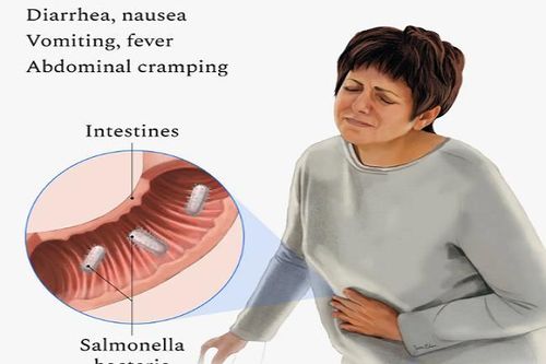 Triệu chứng nhiễm khuẩn Salmonella dễ nhầm lẫn