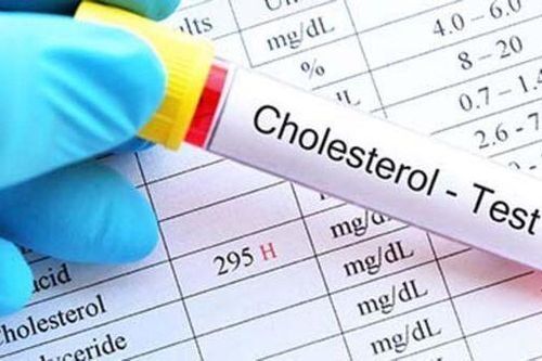 Nghiên cứu mới: 'Cholesterol tốt' không có lợi như người ta tưởng