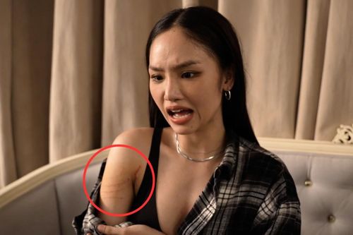 Miu Lê bị thương khi đóng phim khiến khán giả xót xa