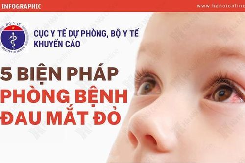 Infographic: 5 biện pháp phòng bệnh đau mắt đỏ