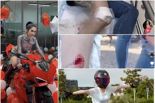 Ngọc Trinh gặp nạn khi lái moto, băng bó khắp người, di chuyển bằng xe lăn