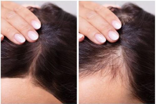 7 bộ phận bên ngoài cơ thể nói lên tuổi thật của bạn