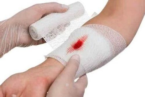 Chủ quan với các vết xước nhỏ, nhiều người bị nhiễm trùng nặng