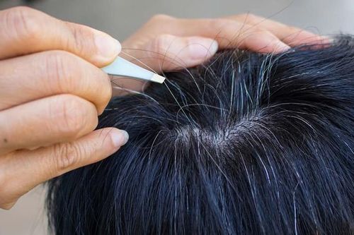 Tóc bạc sớm do đâu? Nguyên nhân khiến tóc bạc ở tuổi 20