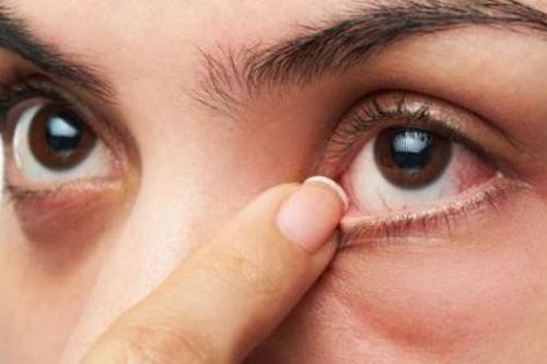Cách phòng và điều trị đau mắt do trang điểm