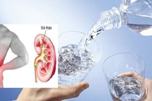 Người bị sỏi thận nên uống bao nhiêu nước mỗi ngày?