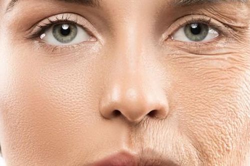 3 loại phẫu thuật xóa nếp nhăn, trẻ hóa khuôn mặt cần biết