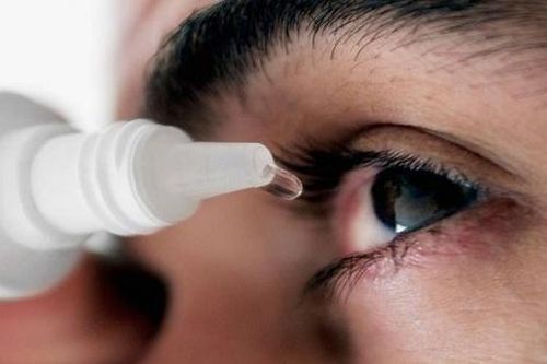 Sau mổ cận thị cần phải biết 5 điều này để ngừa tái phát