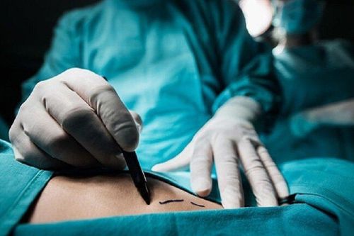 Bi kịch của hoa hậu tài năng qua đời vì biến chứng phẫu thuật thẩm mỹ