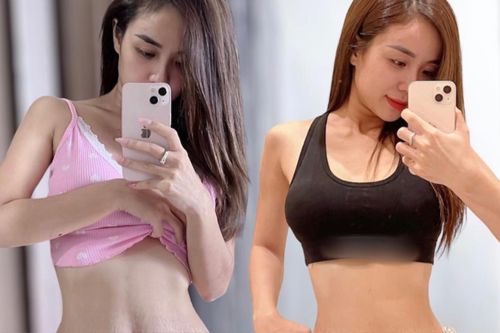 Vợ cũ Hoài Lâm zoom cận bụng rạn chằng chịt sau sinh, nhiều mẹ bỉm đồng cảm