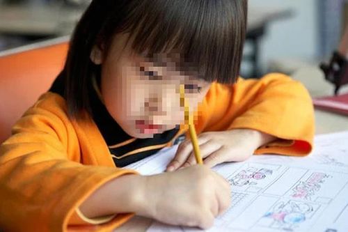 Loạn thị và những biến chứng ở trẻ