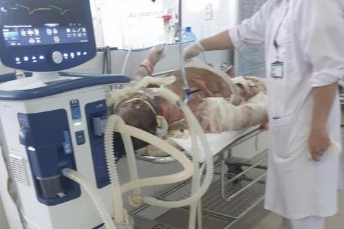 Thêm một người tử vong trong vụ chủ nhà tạt xăng đốt phòng ngủ