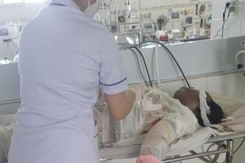 Hoàn cảnh thương tâm của các nạn nhân bị con rể đốt nhà mong được giúp!