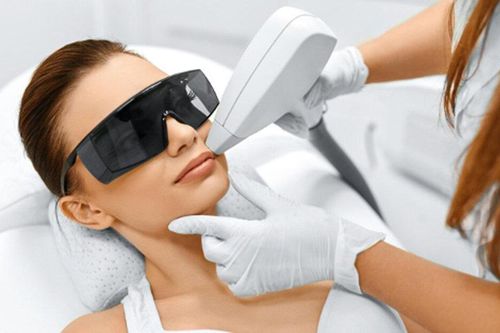 Có nên triệt lông bằng laser?
