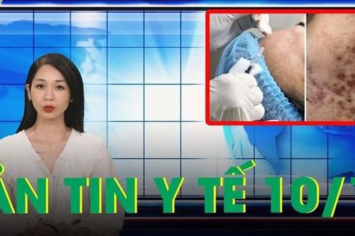 Bản tin y tế 10/10: Chi 30 triệu làm đẹp, cay đắng nhận lại khuôn mặt nham nhở