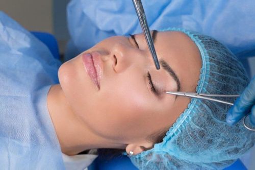 Nhấn mí mắt có phải cắt chỉ?