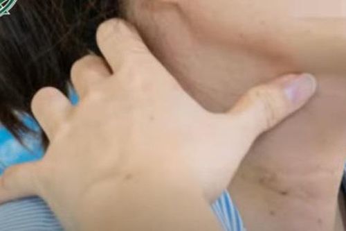 Chàng trai vô tình phát hiện mắc ung thư khi chăm mẹ ở Bệnh Viện K