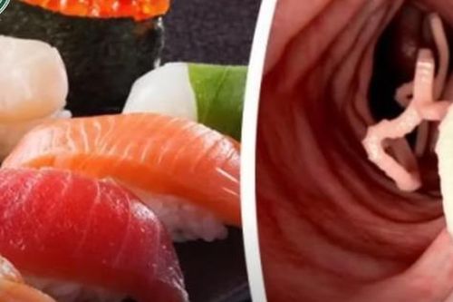 Nhiễm trùng đường mật do sán lá gan cư trú trong ống mật