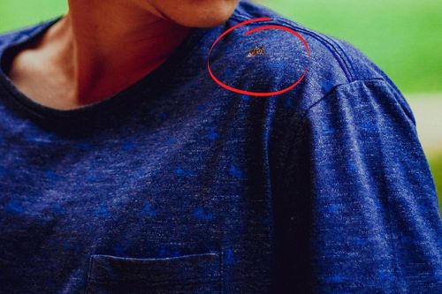 Mặc quần áo màu gì để không bị muỗi đốt?