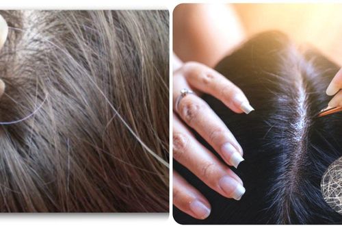 Vì sao không nên nhổ tóc bạc?