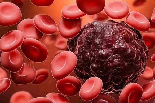 8 biểu hiện của ung thư máu và cách chữa căn bệnh này