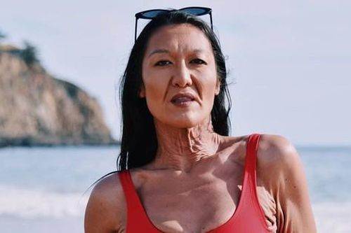 Người mẫu nội y 32 tuổi có làn da nhăn nheo như người già