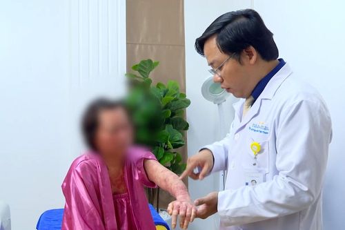 Sưng nề, mưng mủ toàn thân vì tự ý điều trị vẩy nến