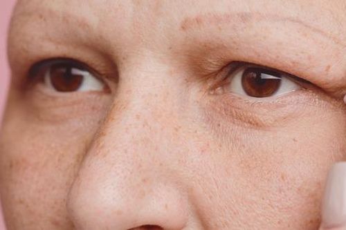 Cách ngăn ngừa rụng lông mi hiệu quả