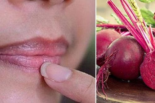 Củ dền trị thâm môi có tốt không