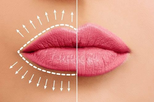 Môi mỏng đi có phải là dấu hiệu của lão hóa?